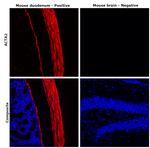 Desmin Antibody in Immunohistochemistry (Paraffin) (IHC (P))