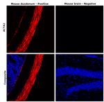 Desmin Antibody in Immunohistochemistry (Paraffin) (IHC (P))