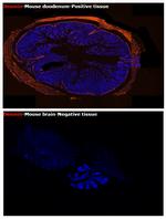 Desmin Antibody in Immunohistochemistry (Paraffin) (IHC (P))