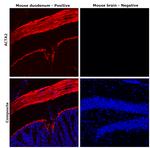 Desmin Antibody