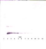 IL-10 Antibody in Western Blot (WB)