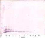 Leptin Antibody in Western Blot (WB)