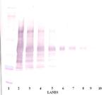 Leptin Antibody in Western Blot (WB)