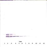 PPBP Antibody in Western Blot (WB)