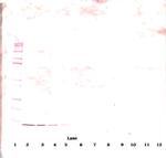 beta-NGF Antibody in Western Blot (WB)