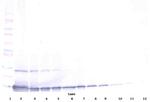 TECK Antibody in Western Blot (WB)