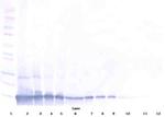 TECK Antibody in Western Blot (WB)