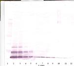 Eotaxin 3 Antibody in Western Blot (WB)