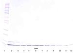 beta-Defensin 1 Antibody in Western Blot (WB)