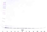 beta-Defensin 1 Antibody in Western Blot (WB)