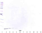 beta-Defensin 1 Antibody in Western Blot (WB)