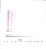 CTAGE5 Antibody in Western Blot (WB)