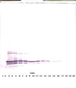 CTAGE5 Antibody in Western Blot (WB)