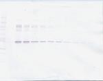 PAI1 Antibody in Western Blot (WB)