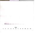 Endostatin Antibody in Western Blot (WB)