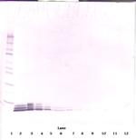 EGF Antibody in Western Blot (WB)