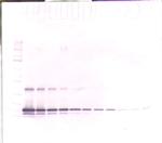 TIMP1 Antibody in Western Blot (WB)