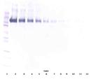 EGFR Antibody in Western Blot (WB)