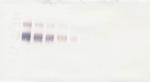 IL4R (soluble) Antibody in Western Blot (WB)