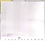 EGF Antibody in Western Blot (WB)