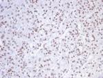 SMARCAL1 Antibody in Immunohistochemistry (Paraffin) (IHC (P))