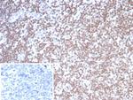 SMARCAL1 Antibody in Immunohistochemistry (Paraffin) (IHC (P))