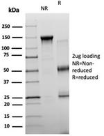 NEUROG3/Neurogenin 3/NGN3 (Transcription Factor) Antibody in SDS-PAGE (SDS-PAGE)