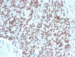 PAX2 (Renal Cell and Ovarian Carcinoma Marker) Antibody in Immunohistochemistry (Paraffin) (IHC (P))