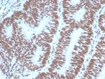 PAX2 (Renal Cell and Ovarian Carcinoma Marker) Antibody in Immunohistochemistry (Paraffin) (IHC (P))