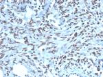 PAX2 (Renal Cell and Ovarian Carcinoma Marker) Antibody in Immunohistochemistry (Paraffin) (IHC (P))