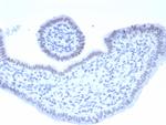 PAX2 (Renal Cell and Ovarian Carcinoma Marker) Antibody in Immunohistochemistry (Paraffin) (IHC (P))