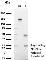 PAX2 (Renal Cell and Ovarian Carcinoma Marker) Antibody in SDS-PAGE (SDS-PAGE)