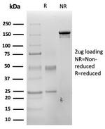 PAX3 Antibody in SDS-PAGE (SDS-PAGE)