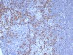 PAX5/BSAP (Early B-Cell Marker) Antibody in Immunohistochemistry (Paraffin) (IHC (P))