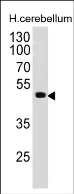 PAX6 Antibody in Western Blot (WB)