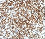 PAX7 (Rhabdomyosarcoma Marker) Antibody in Immunohistochemistry (Paraffin) (IHC (P))