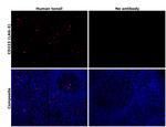 CD223 (LAG-3) Antibody in Immunohistochemistry (Paraffin) (IHC (P))