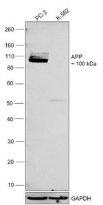 beta Amyloid Antibody