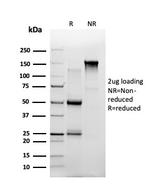 Th-Pok/ZBTB7B Antibody in SDS-PAGE (SDS-PAGE)