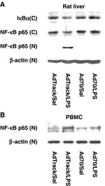 NFkB p65 Antibody in Western Blot (WB)