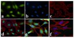 NFkB p65 Antibody in Immunocytochemistry (ICC/IF)