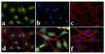 NFkB p65 Antibody