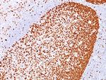 PCNA (Proliferating Cell Nuclear Antigen) (G1- and S-phase Marker) Antibody in Immunohistochemistry (Paraffin) (IHC (P))