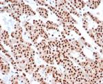 PCNA (Proliferating Cell Nuclear Antigen) (G1- and S-phase Marker) Antibody in Immunohistochemistry (Paraffin) (IHC (P))