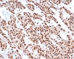 PCNA (Proliferating Cell Nuclear Antigen) (G1- and S-phase Marker) Antibody in Immunohistochemistry (Paraffin) (IHC (P))