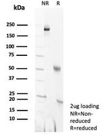 PCNA (Proliferating Cell Nuclear Antigen) (G1- and S-phase Marker) Antibody in SDS-PAGE (SDS-PAGE)