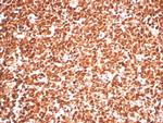 PCNA (Proliferating Cell Nuclear Antigen) (G1- and S-phase Marker) Antibody in Immunohistochemistry (Paraffin) (IHC (P))