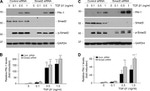 SMAD3 Antibody in Western Blot (WB)