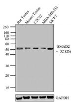 SMAD2 Antibody in Western Blot (WB)