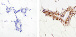 SMAD2 Antibody in Immunohistochemistry (Paraffin) (IHC (P))